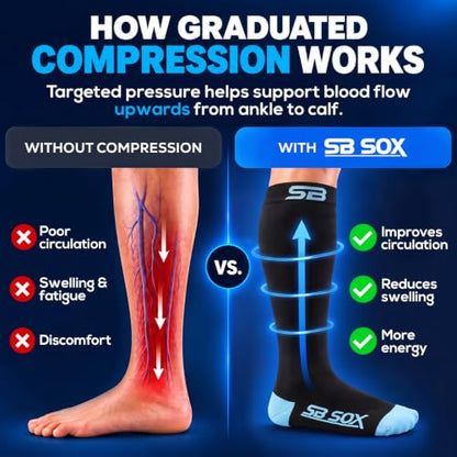 SB SOX Compression Socks for Men & Women (20-30mmHg) - color: Black/Blue, size: Small
